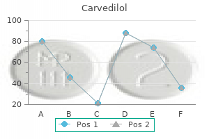 carvedilol 25 mg discount mastercard