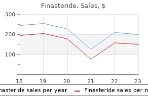 cheap finasteride 1 mg mastercard