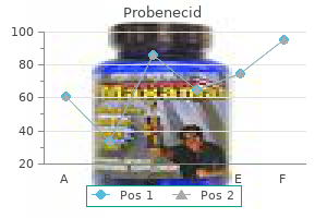 probenecid 500mg order with mastercard