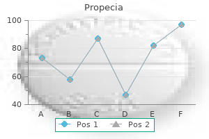 propecia 5 mg quality