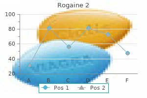 60 ml rogaine 2 generic visa