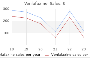 buy 75 mg venlafaxine visa